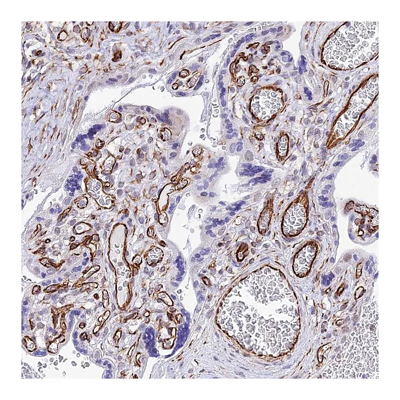 Atlas Antibodies Anti-ZNF652 Antibody