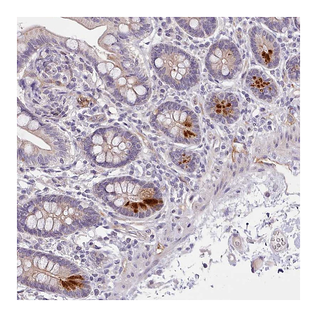Atlas Antibodies Anti-ZNF658 Antibody