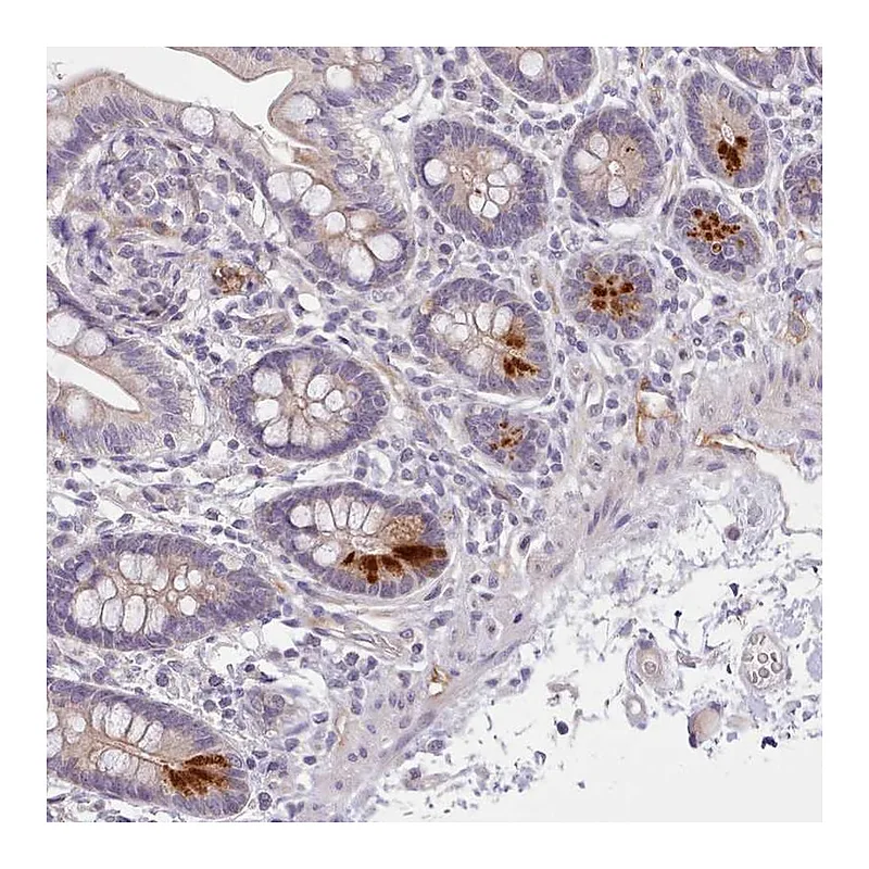 Atlas Antibodies Anti-ZNF658 Antibody