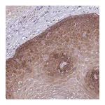 Atlas Antibodies Anti-ZNF658 Antibody