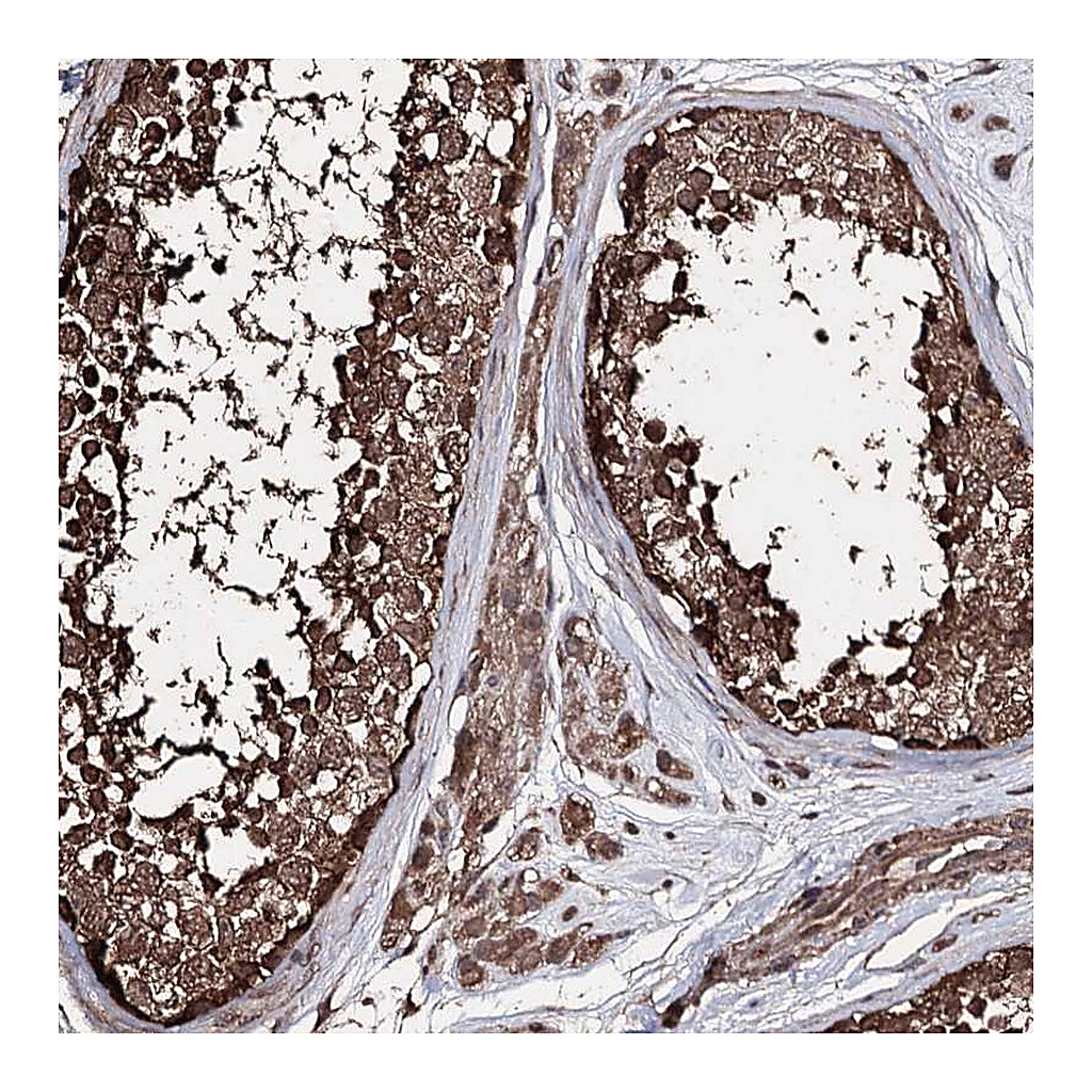 Atlas Antibodies Anti-ZNF662 Antibody