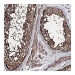 Atlas Antibodies Anti-ZNF662 Antibody