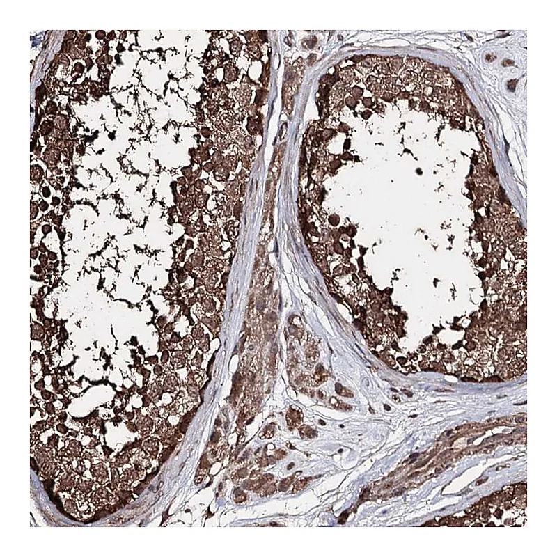 Atlas Antibodies Anti-ZNF662 Antibody