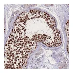 Atlas Antibodies Anti-ZNF662 Antibody