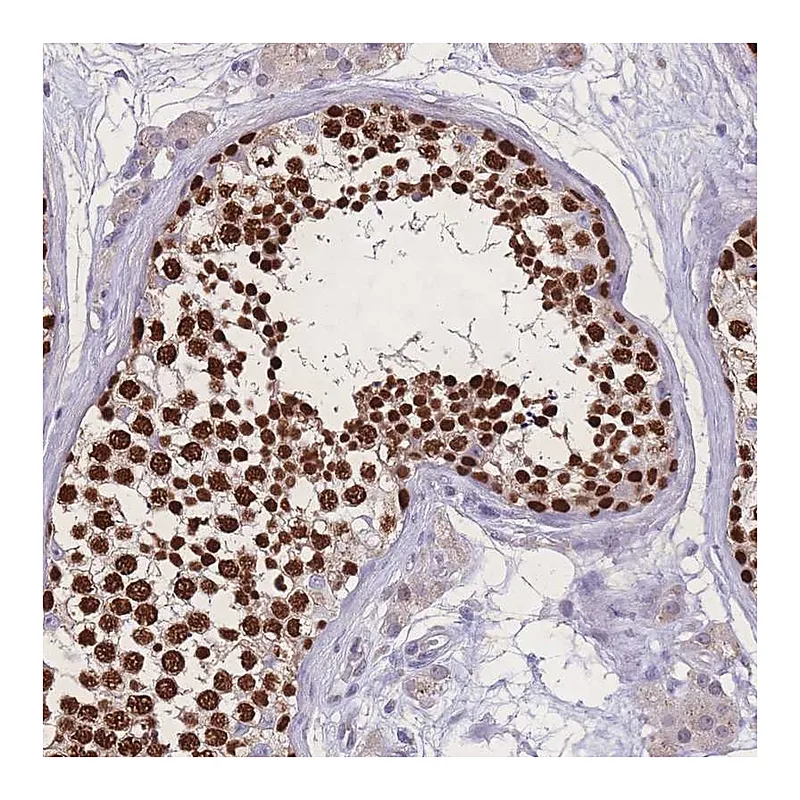 Atlas Antibodies Anti-ZNF662 Antibody