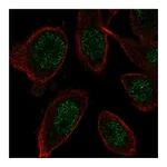 Atlas Antibodies Anti-ZNF664 Antibody