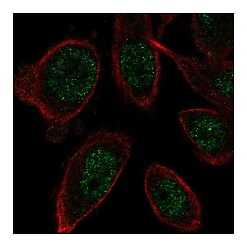 Atlas Antibodies Anti-ZNF664 Antibody
