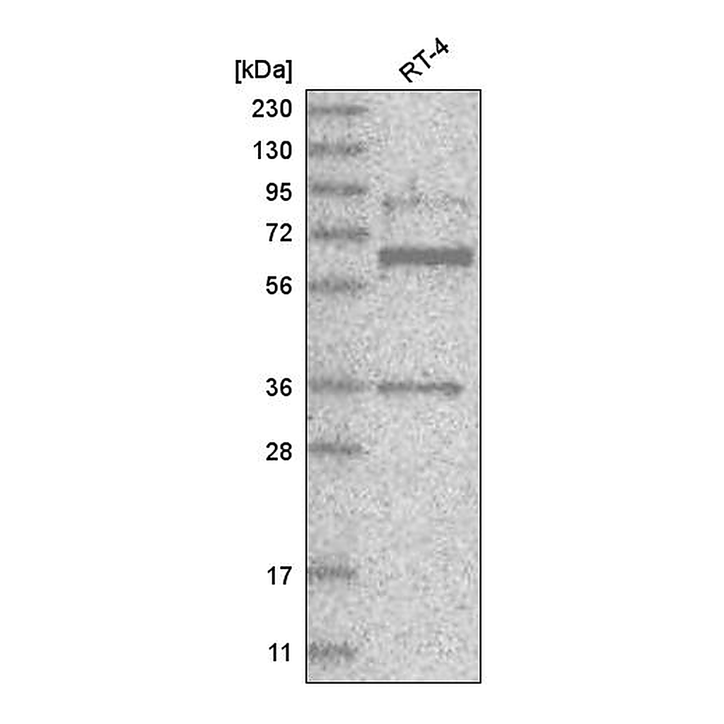 Atlas Antibodies Anti-ZNF667 Antibody