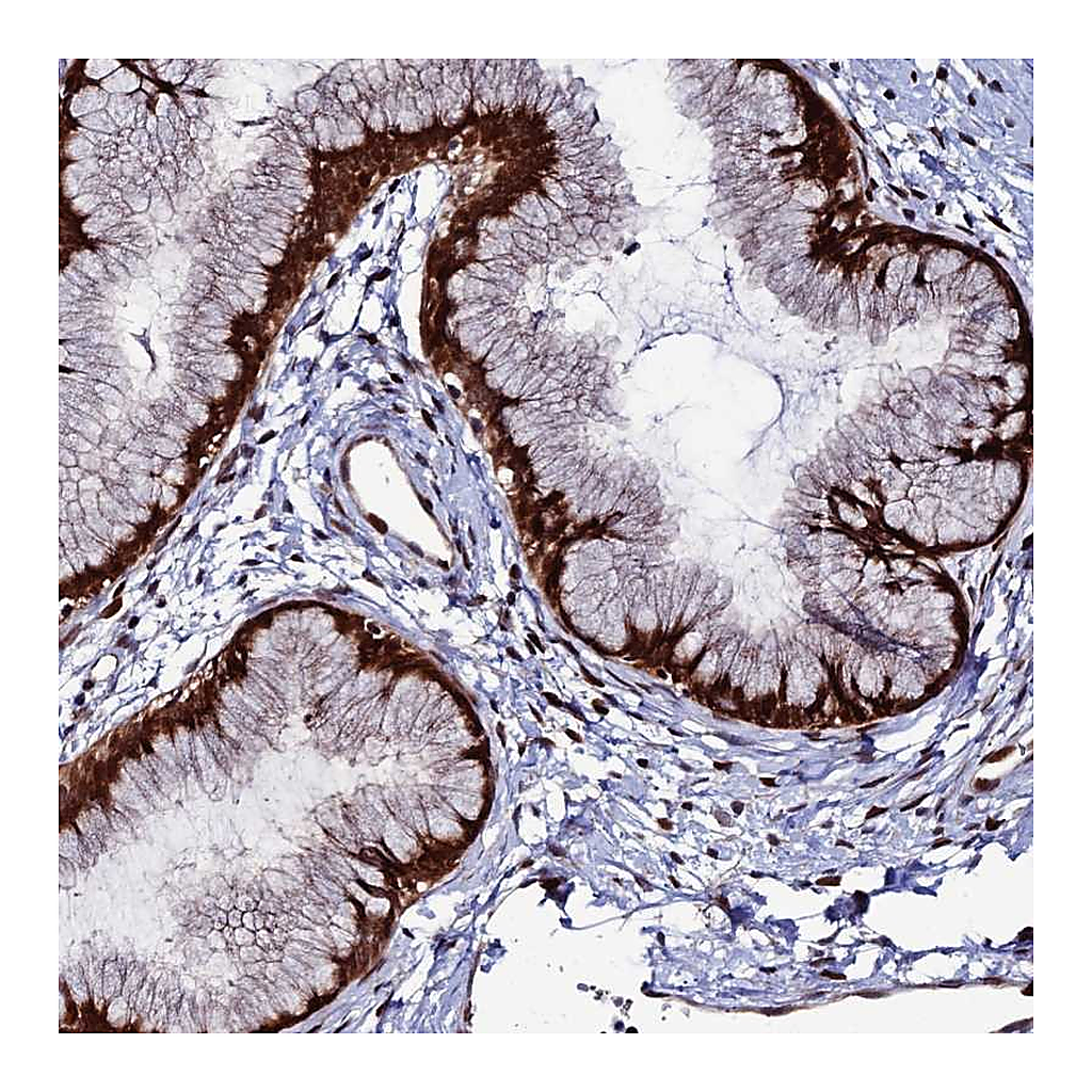 Atlas Antibodies Anti-ZNF668 Antibody