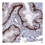 Atlas Antibodies Anti-ZNF668 Antibody