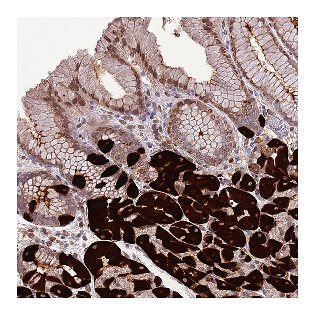 Atlas Antibodies Anti-ZNF665 Antibody