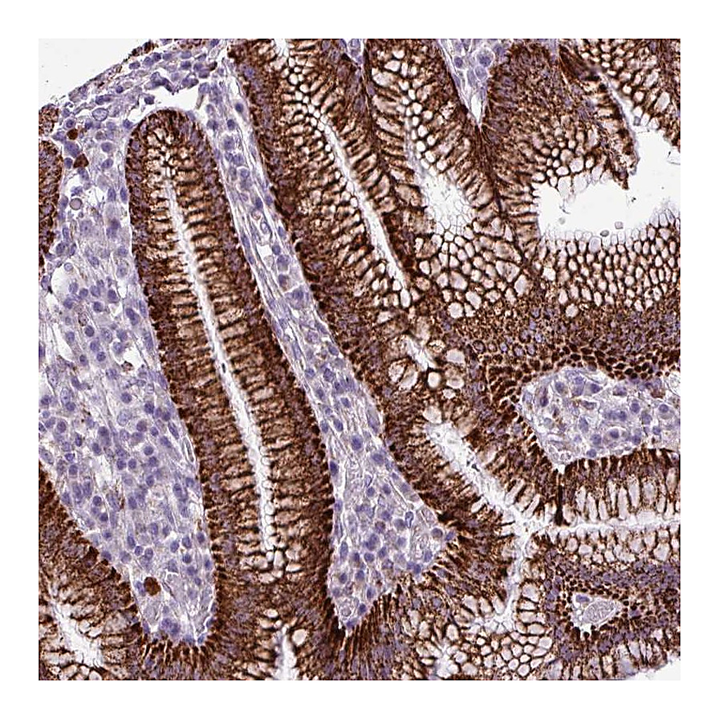 Atlas Antibodies Anti-ZNF667 Antibody