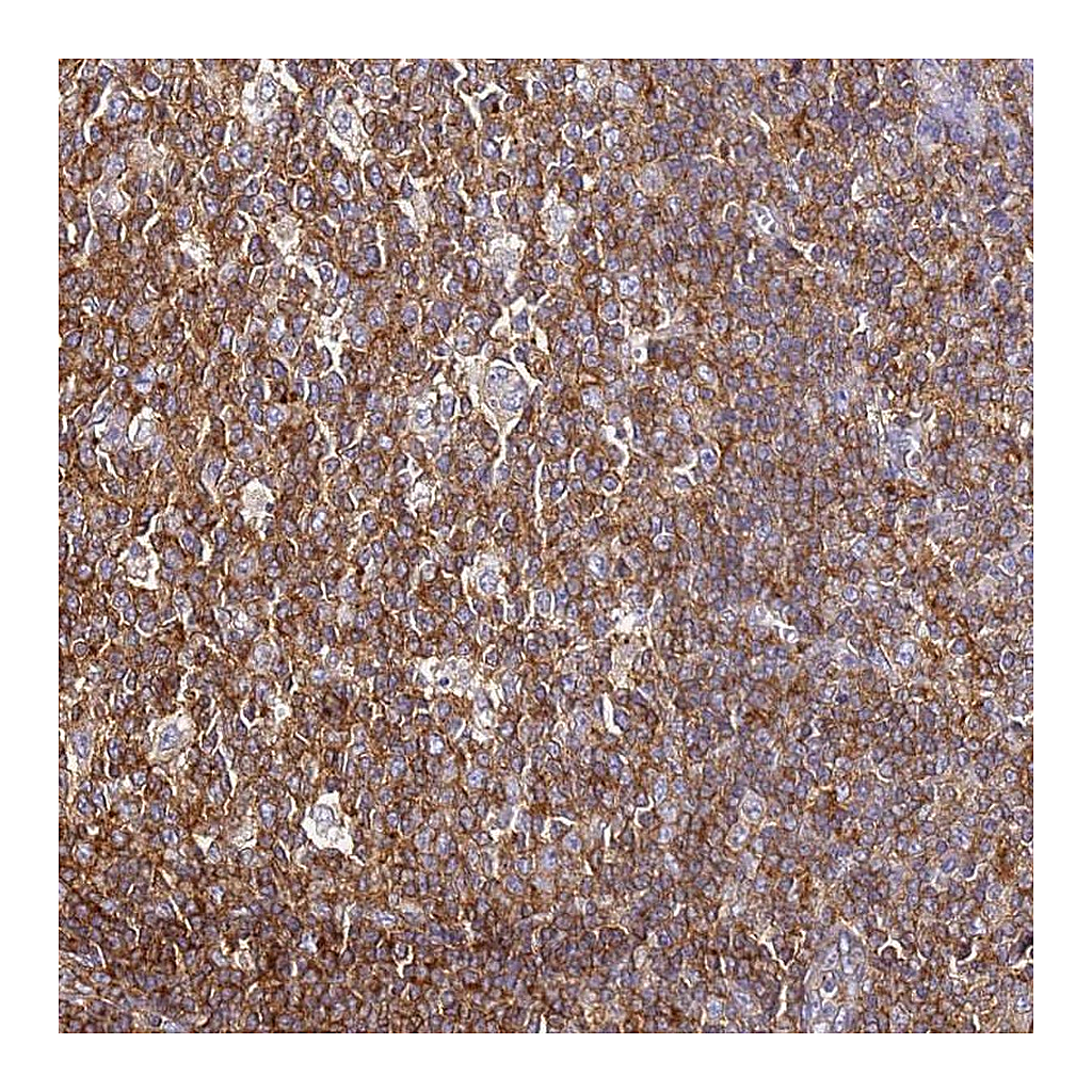 Atlas Antibodies Anti-ZNF671 Antibody