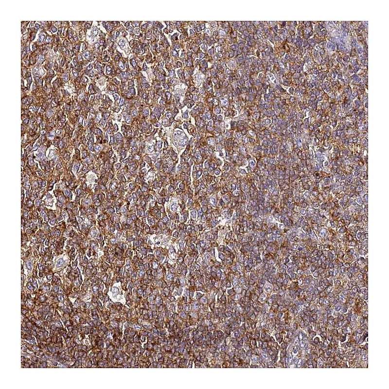 Atlas Antibodies Anti-ZNF671 Antibody