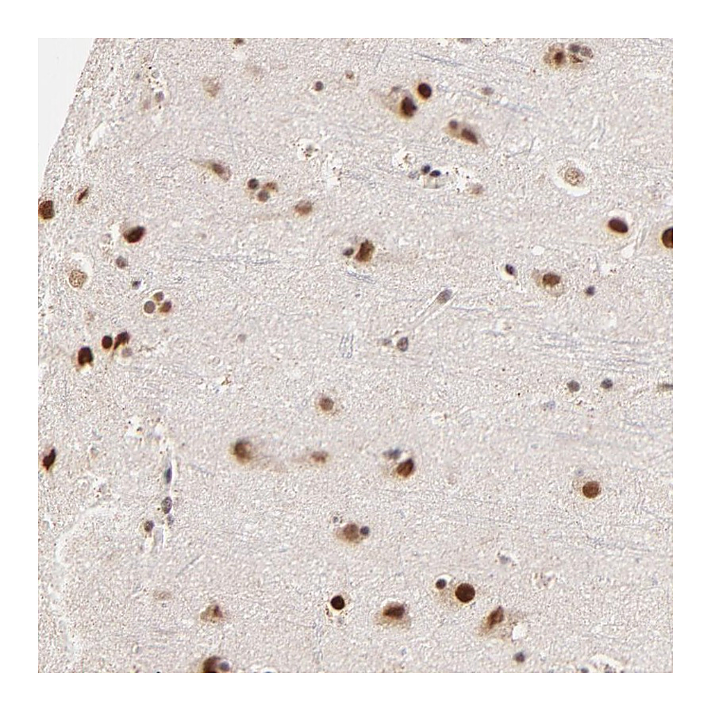 Atlas Antibodies Anti-ZNF670 Antibody