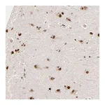 Atlas Antibodies Anti-ZNF670 Antibody