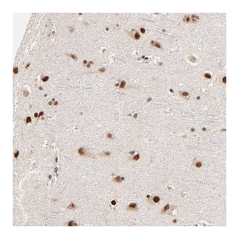 Atlas Antibodies Anti-ZNF670 Antibody