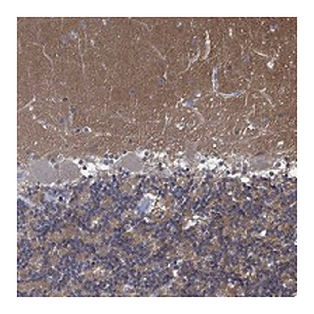 Atlas Antibodies Anti-ZNF671 Antibody