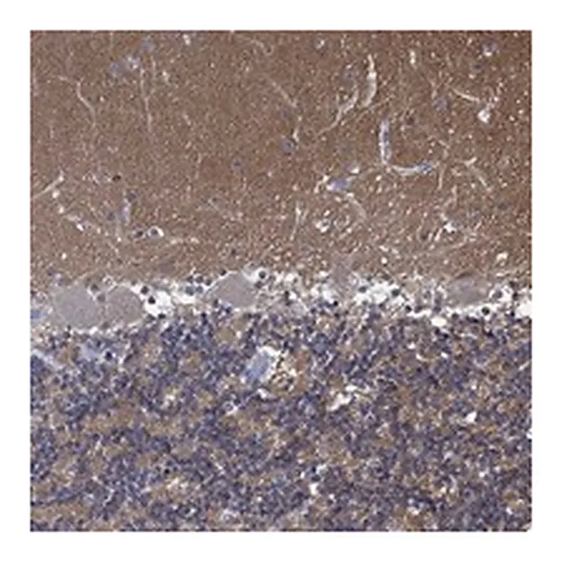 Atlas Antibodies Anti-ZNF671 Antibody