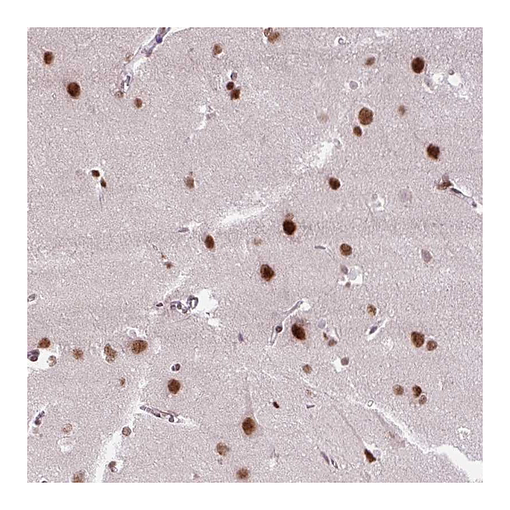 Atlas Antibodies Anti-ZNF672 Antibody