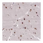 Atlas Antibodies Anti-ZNF672 Antibody