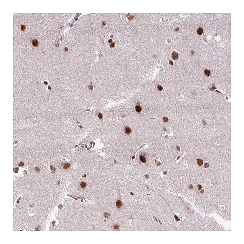 Atlas Antibodies Anti-ZNF672 Antibody
