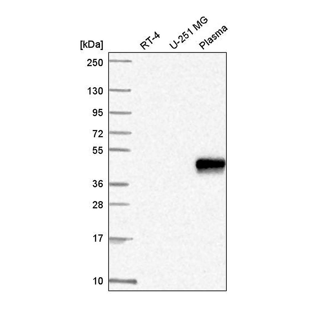 Atlas Antibodies Anti-ZNF672 Antibody