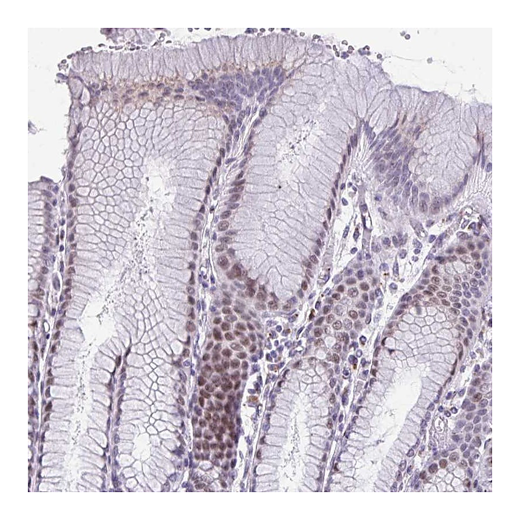 Atlas Antibodies Anti-ZNF682 Antibody