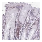 Atlas Antibodies Anti-ZNF682 Antibody