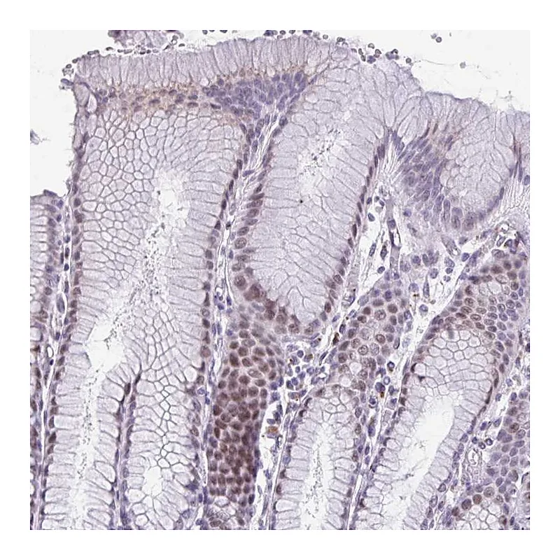 Atlas Antibodies Anti-ZNF682 Antibody