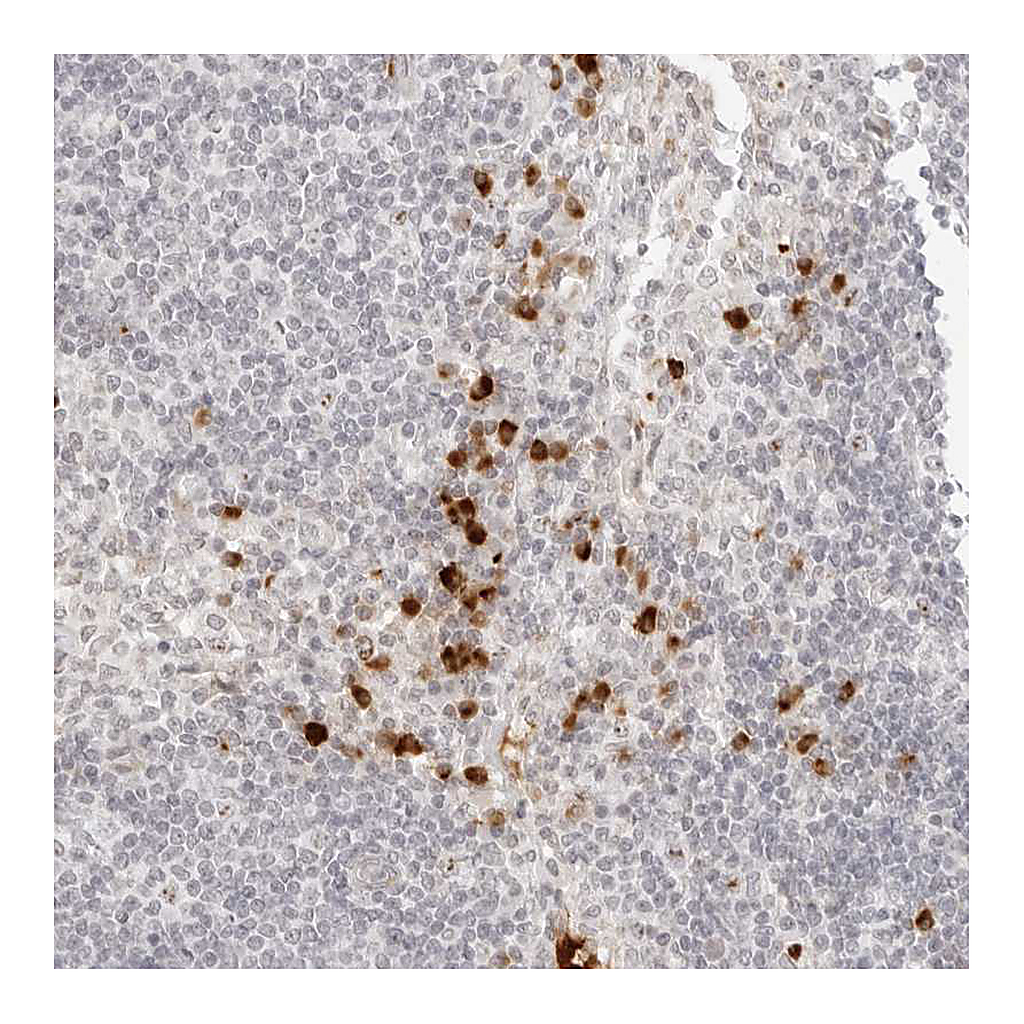 Atlas Antibodies Anti-ZNF678 Antibody