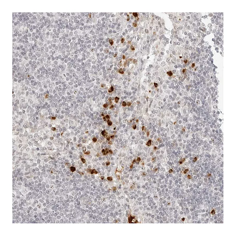 Atlas Antibodies Anti-ZNF678 Antibody