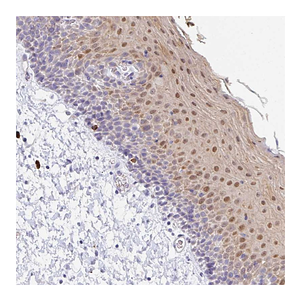 Atlas Antibodies Anti-ZNF684 Antibody
