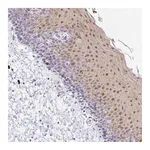 Atlas Antibodies Anti-ZNF684 Antibody