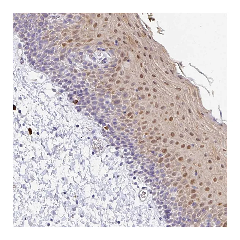 Atlas Antibodies Anti-ZNF684 Antibody