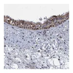 Atlas Antibodies Anti-ZNF677 Antibody