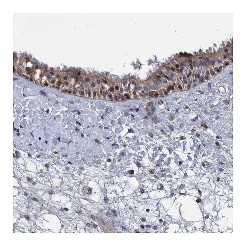 Atlas Antibodies Anti-ZNF677 Antibody