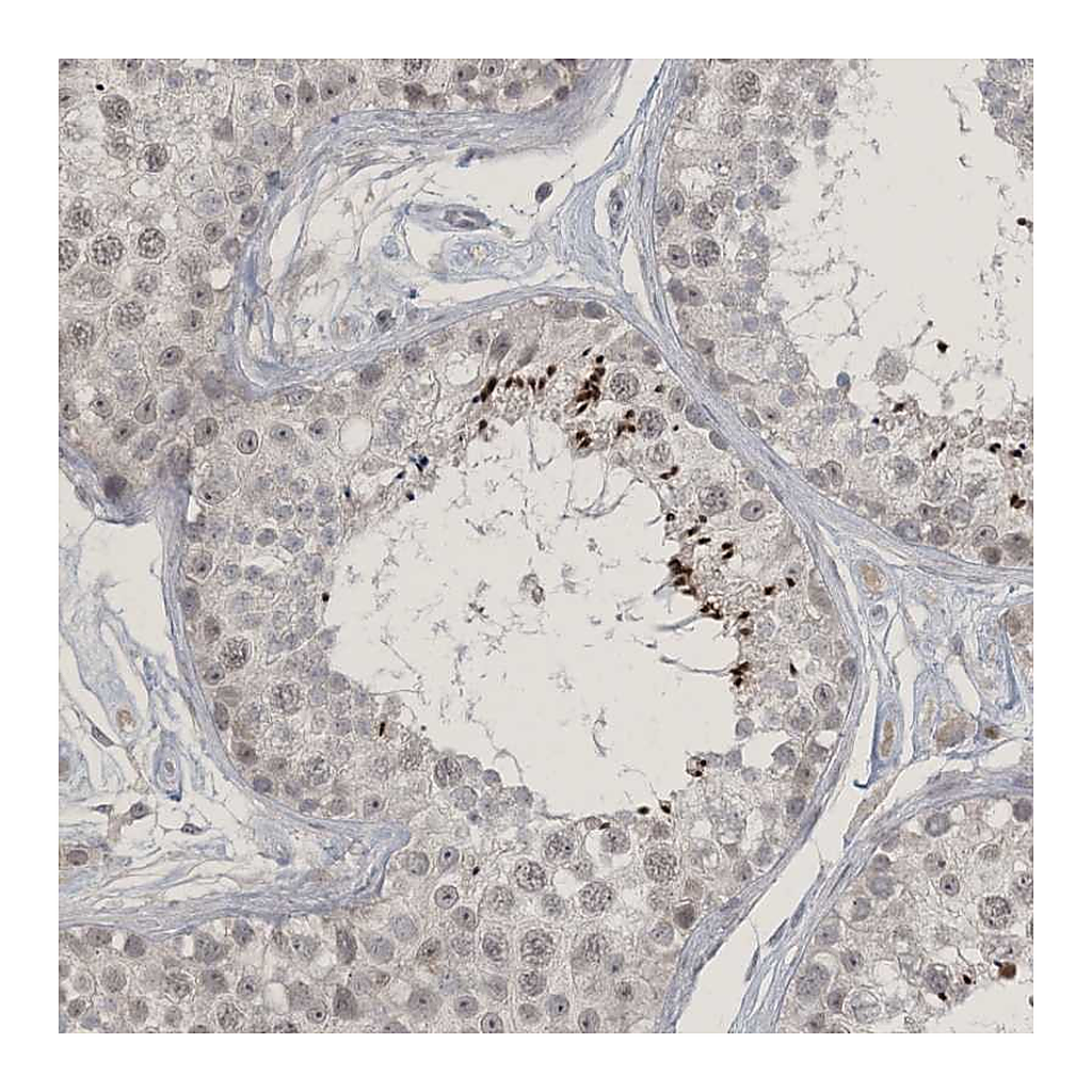 Atlas Antibodies Anti-ZNF674 Antibody