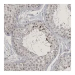 Atlas Antibodies Anti-ZNF674 Antibody