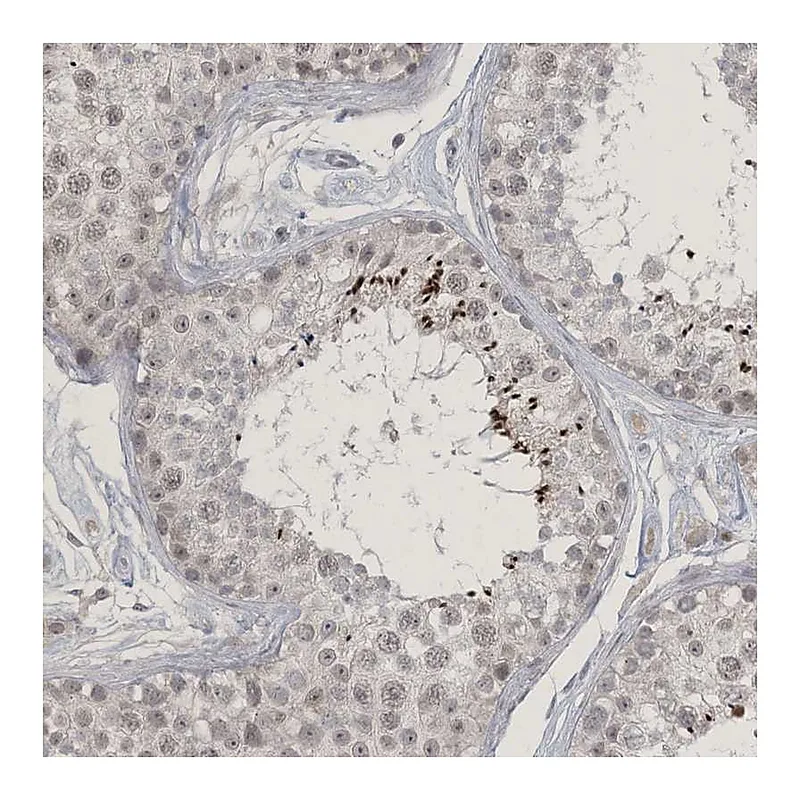 Atlas Antibodies Anti-ZNF674 Antibody