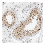 Atlas Antibodies Anti-ZNF683 Antibody