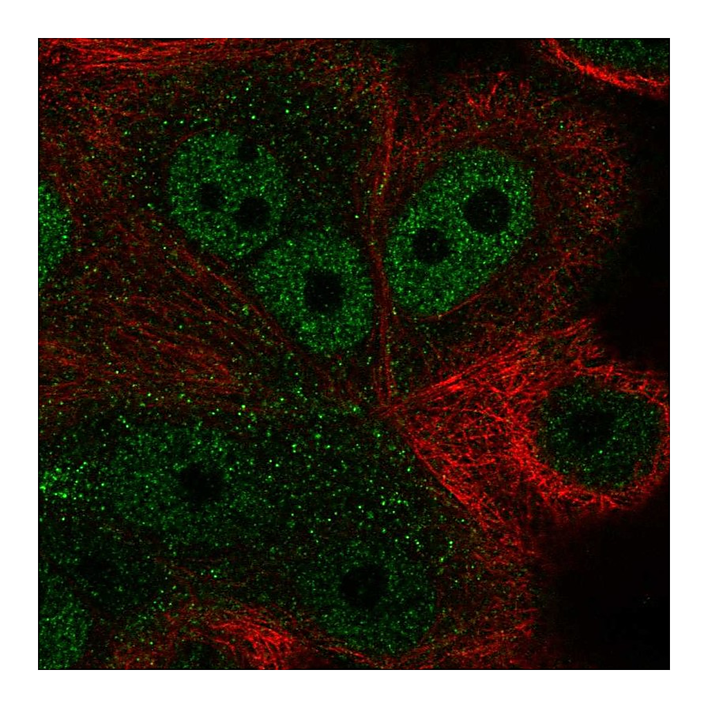 Atlas Antibodies Anti-ZNF687 Antibody