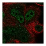 Atlas Antibodies Anti-ZNF687 Antibody