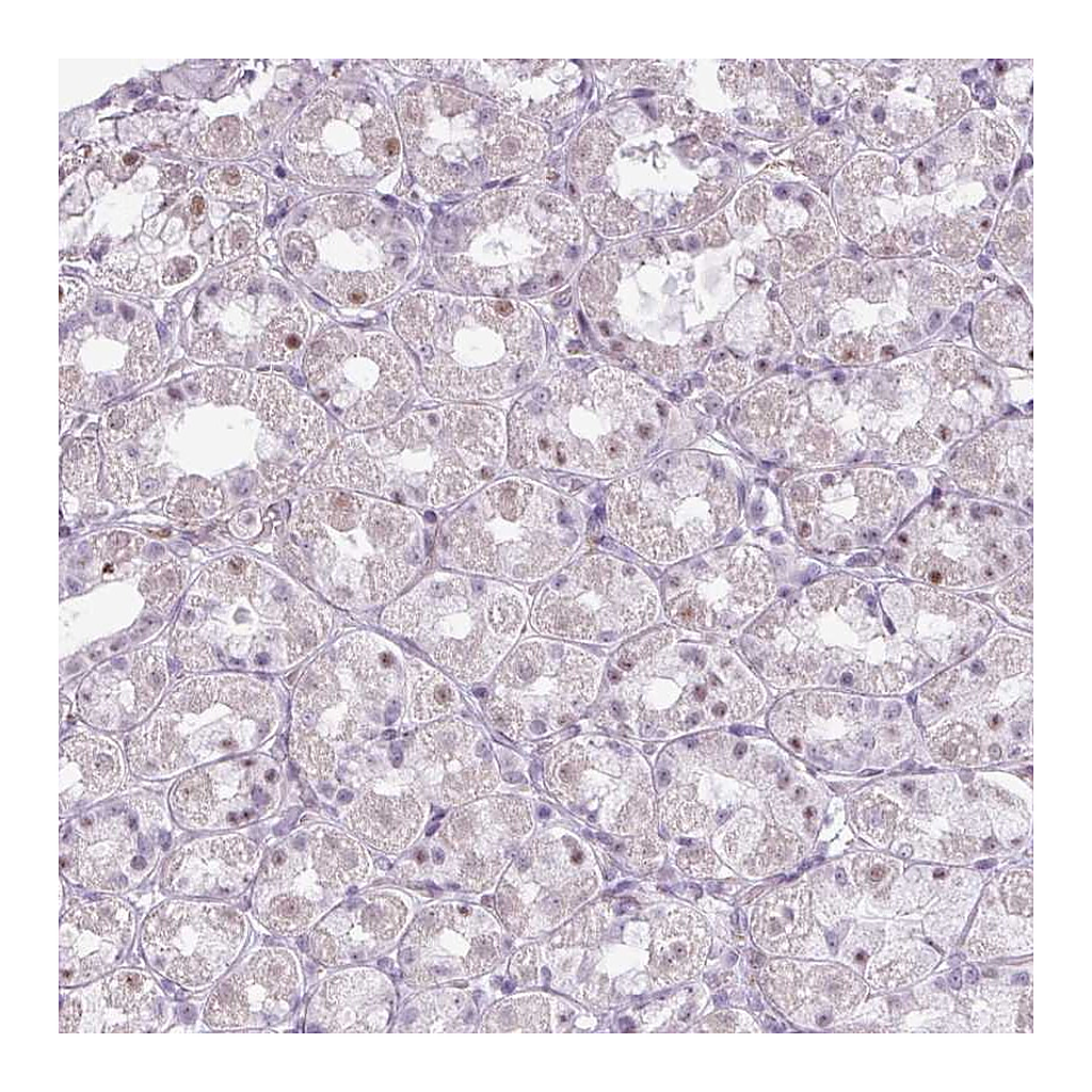 Atlas Antibodies Anti-ZNF688 Antibody