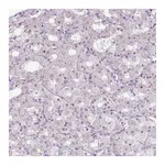 Atlas Antibodies Anti-ZNF688 Antibody