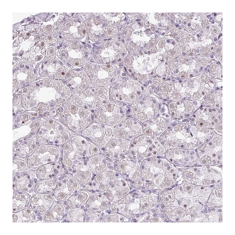 Atlas Antibodies Anti-ZNF688 Antibody