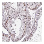 Atlas Antibodies Anti-ZNF689 Antibody