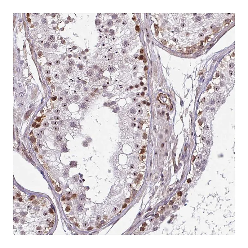 Atlas Antibodies Anti-ZNF689 Antibody
