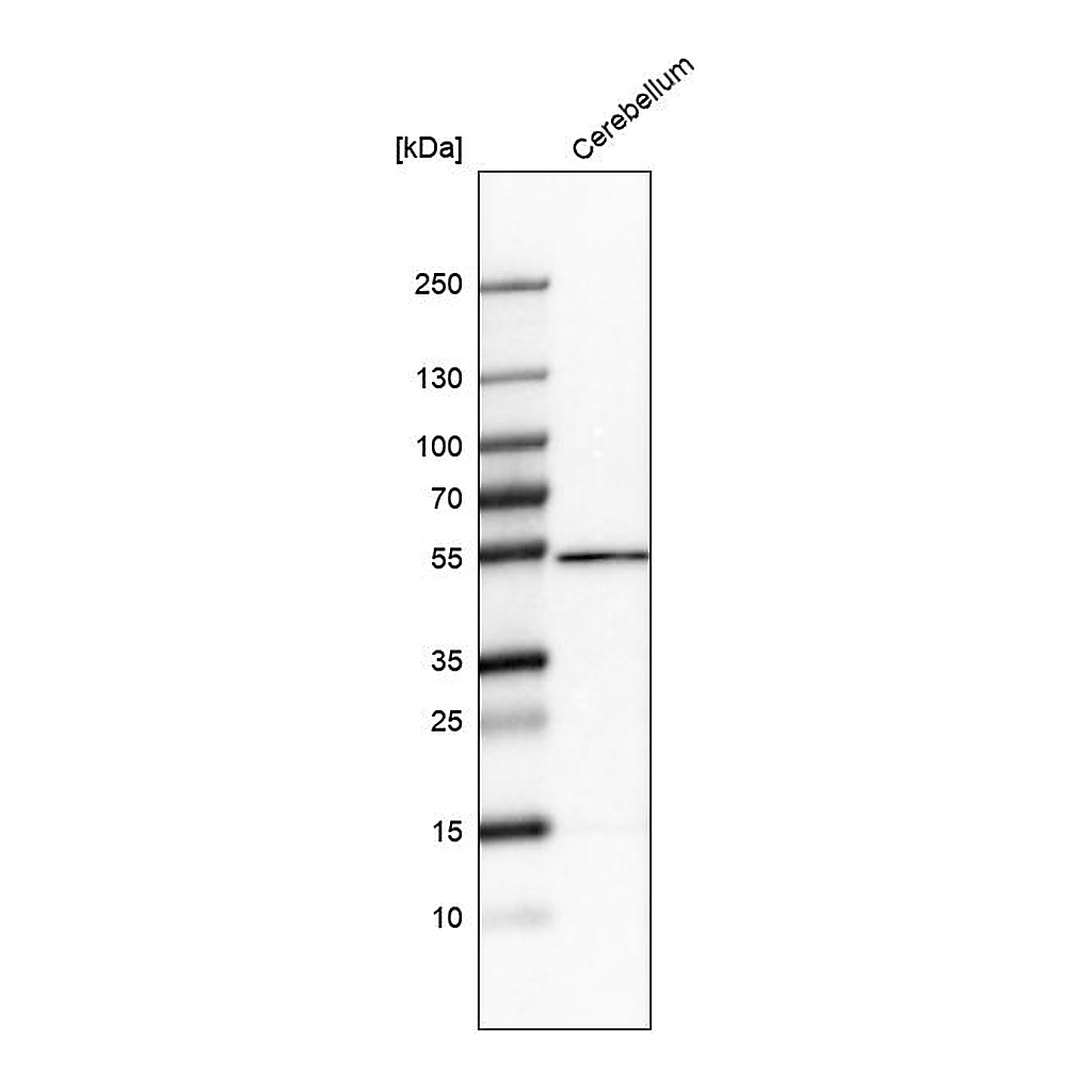 Atlas Antibodies Anti-ZNF692 Antibody