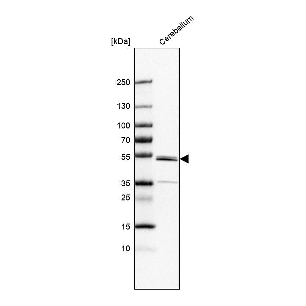 Atlas Antibodies Anti-ZNF692 Antibody